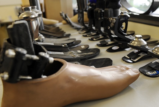 prosthetics-for-the-poor